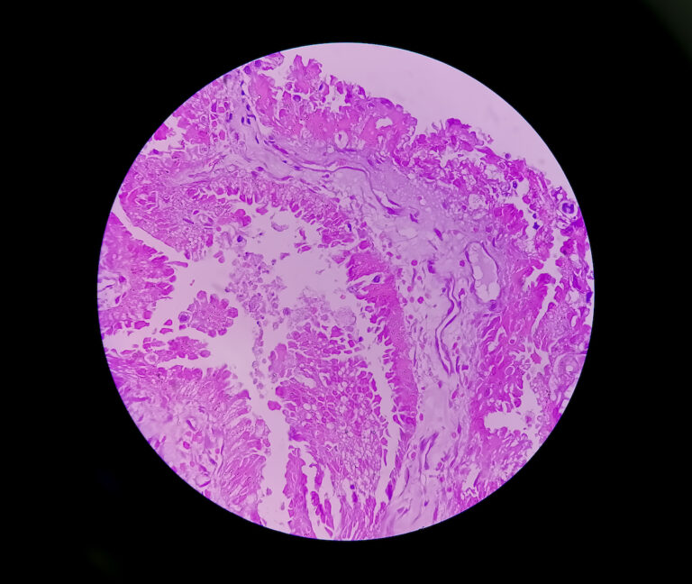 Revolution in der Pathologie